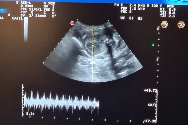 [Image: 251219%20fennel%201.jpg]